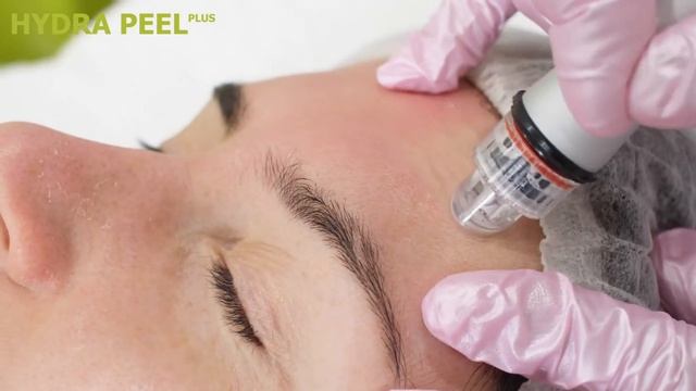 ГИДРОПИЛИНГ HYDRAFACIAL MD – Инновационная методика для очищения и увлажнения кожи смотреть онлайн