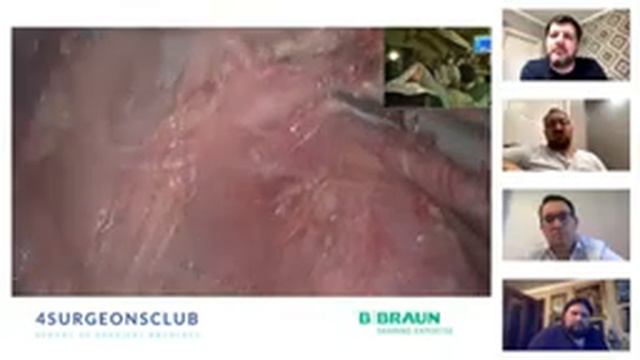 Лапароскопическая мультивисцеральная резекция при местно распространенном раке сигмовидной кишки 30 смотреть онлайн