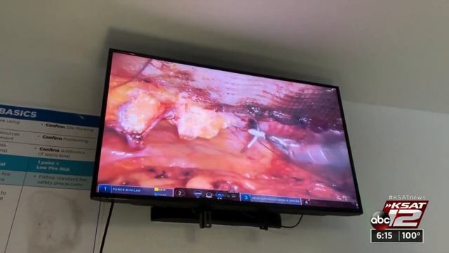 Robotic hernia surgery speeds up recovery смотреть онлайн