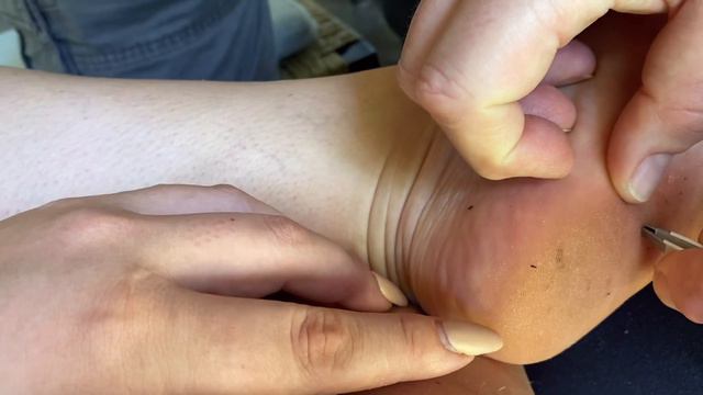 I STEPPED ON A SEA URCHIN! ⚠️🆘 смотреть онлайн