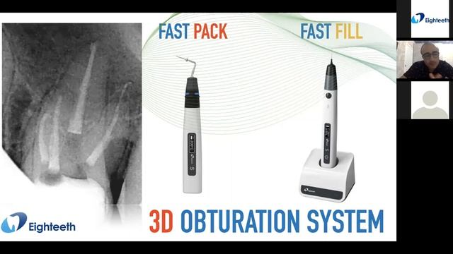 Вебинар на русском языке- Насим Ахатов- Тема: Гибкая эндондонтия с системой E Flex смотреть онлайн