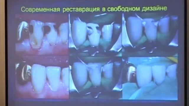Мастер-класс С.В Радлинского. ПИК32 смотреть онлайн