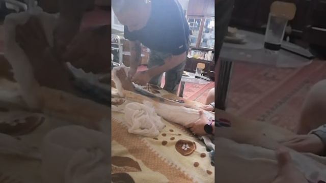 Мы снимаем гипс. смотреть онлайн