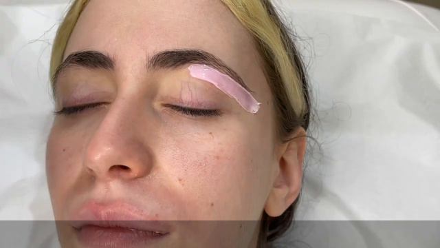 Депиляция на лице Selfie