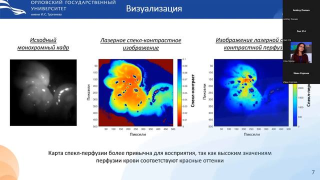 Голубова Н.В. Изучение возможностей метода лазерной спекл-контрастной визуализации через лапароскоп смотреть онлайн