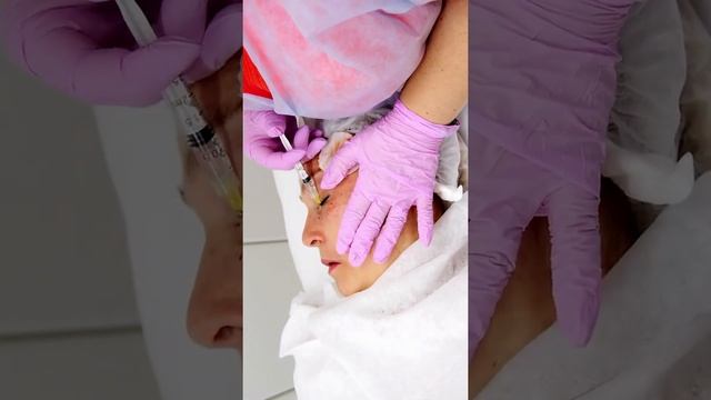 Ревитализация периорбиты Венецианской маской и Premium ReVita Bio EYES