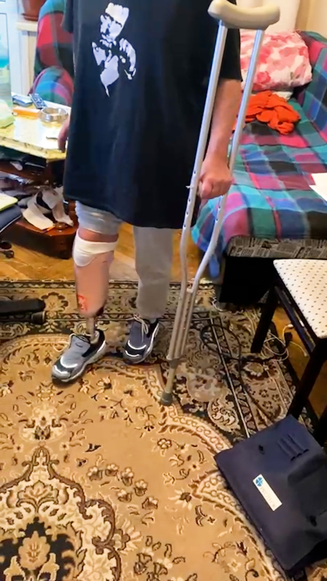 Её протез голени: первая примерочная гильза. смотреть онлайн