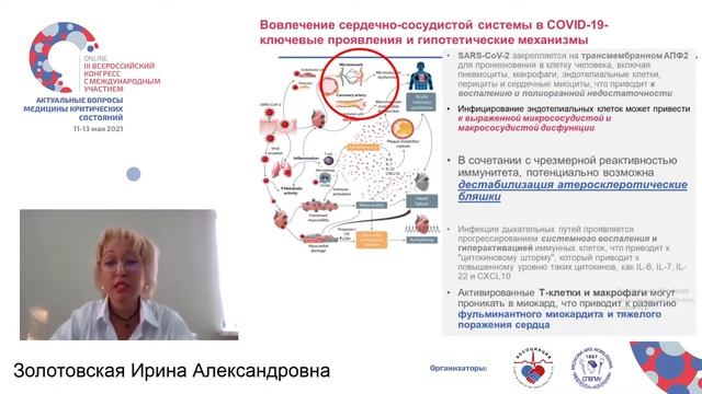 Тромбозы при ковид 19 Золотовская И.А. смотреть онлайн