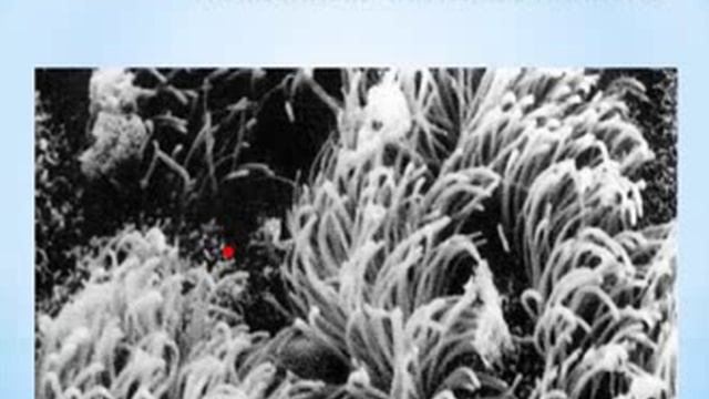 Респираторные заболевания. Практика применения препаратов линейки Диэнай. 2014 смотреть онлайн