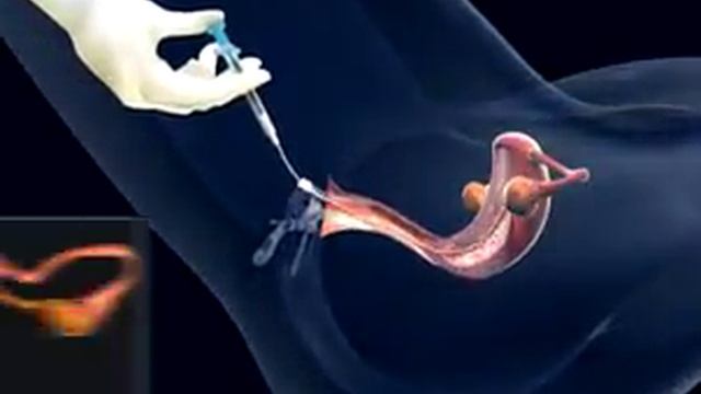 Insemination смотреть онлайн