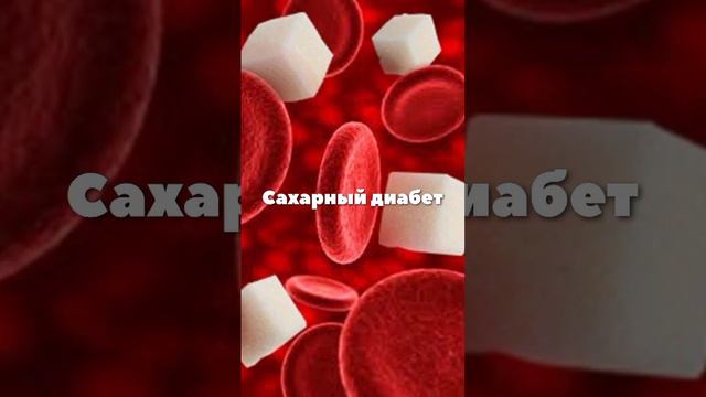 Атеросклероз - это закупорка артерии. Опасное заболевания которая приводит к болезням сердце. смотреть онлайн