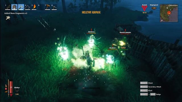 Valheim - Skeleton Suprise (meme) смотреть онлайн