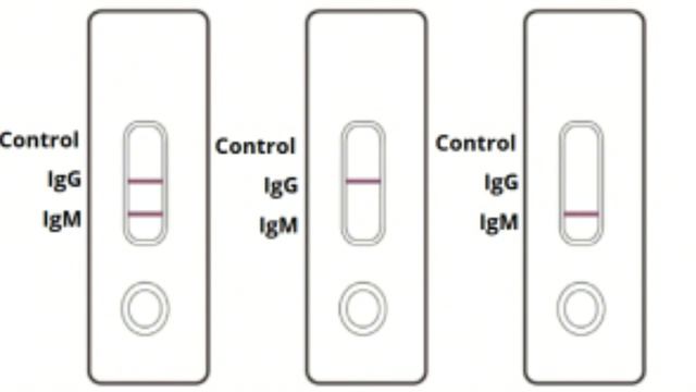 Rapid kit test for COVID 19 |Rapid antibiotic test | IgM/IgG | tamil | RaDiO DaPpA смотреть онлайн