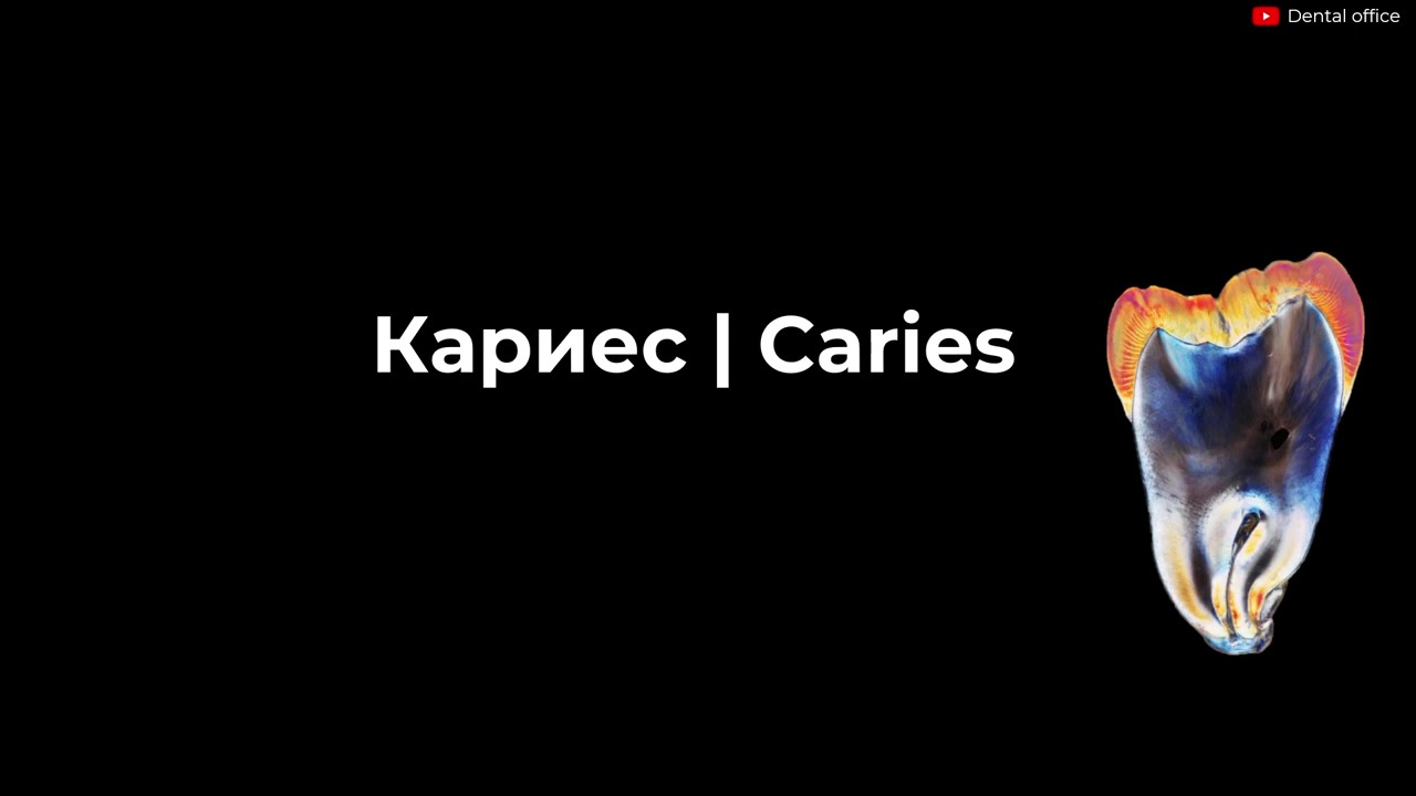 Кариес | Современные представления о кариесе | Откуда берется кариес ?