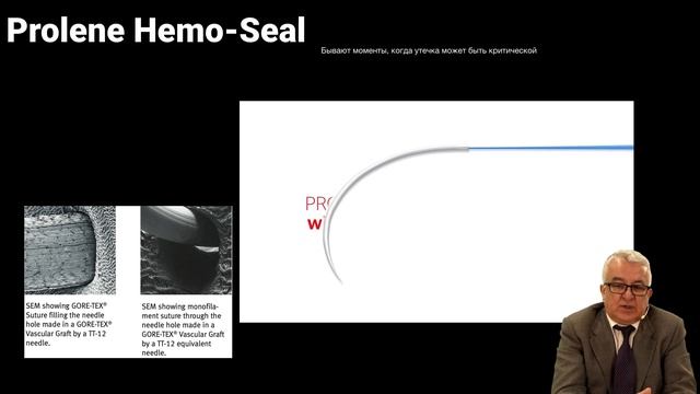 Шовные материалы. Часть 3. Нерассасывающиеся шовные материалы. смотреть онлайн