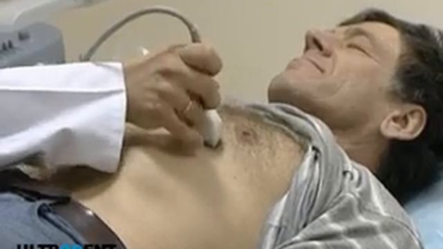 UltraDent УЗИ 15 xViD смотреть онлайн
