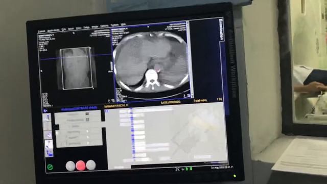 #КТ#ОБП#контраст#диагностика