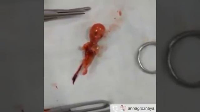 Что значит аборт смотреть онлайн