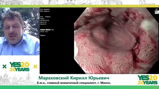 77. Эозинофильный эзофагит и его маски в практике педиатра. Мараховский К. Ю., Аксенчик М. Г. смотреть онлайн