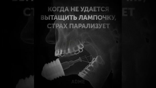 Почему нельзя вытащить лампочку...¿? смотреть онлайн