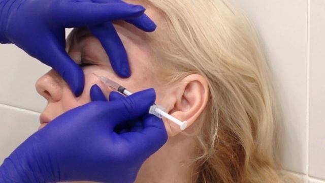 АирисКом: студенты учатся; семинар по ботоксу, показ преподавателя смотреть онлайн