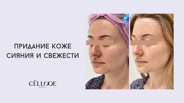Косметика CELLOOE: результаты профессионального ухода за лицом