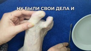Как подлечить ноги? Отбелить ногти? И сделать необрезной педикюр всего за 20 рублей?