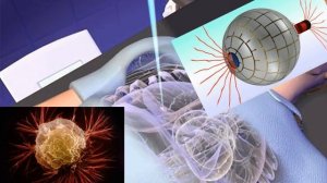 Лечение магнитами рецепты 38 46  Магнитотерапия будущего,
