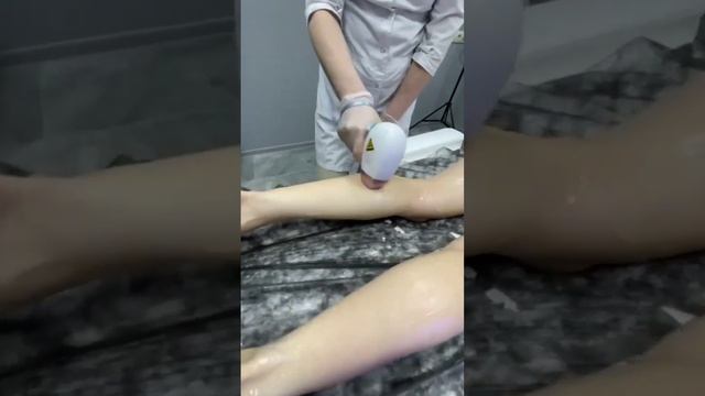 Лазерная эпиляция г. Казань
