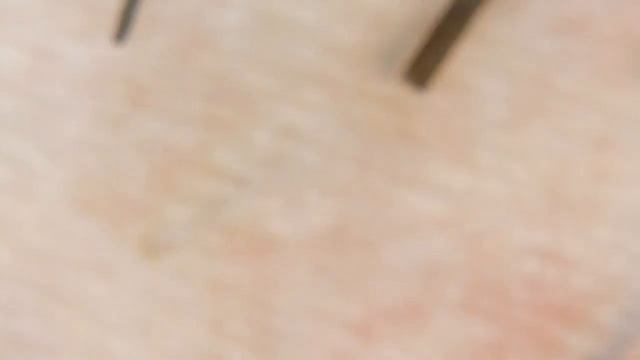 Человек под микроскопом в увеличении 150 крат смотреть онлайн