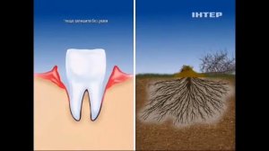 Зубная паста Parodontax Для тех кто помечает под час очищает зубов