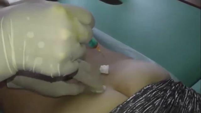 Часть 10 Практика постановки препарата. Лекция Солодовниковой Е.С смотреть онлайн