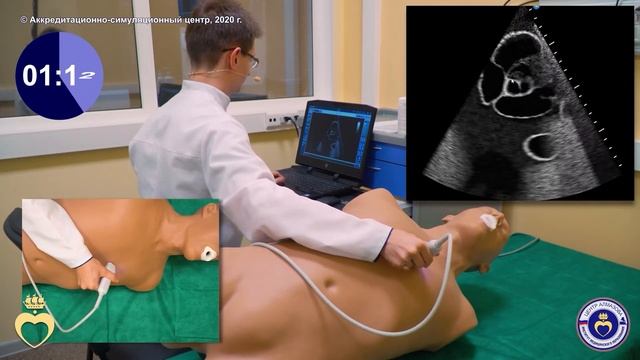 Трансторакальная эхокардиография. Парастернальный доступ – короткие оси левого желудочка смотреть онлайн