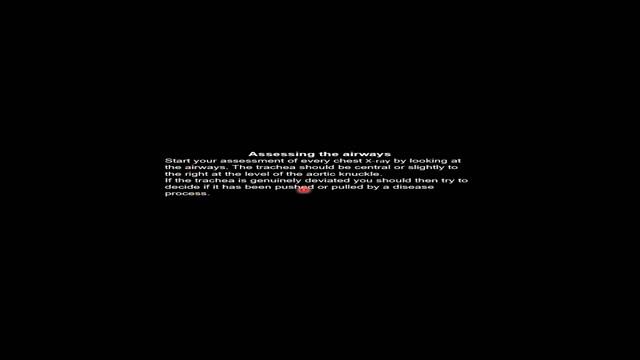 Ko'krak qafasi anatomiyasi. 1-qism. YUNUSOV UMRBEK ODILOVICH - XIMCHAN klinikasi rentgenolog vrach смотреть онлайн