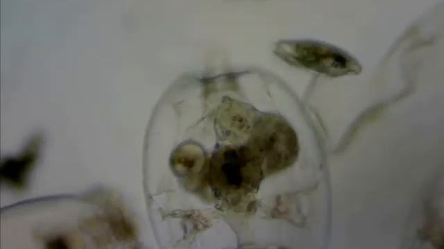Rotifer Zooplankton- Brachionus plicatilis смотреть онлайн