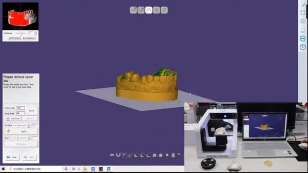 DX300 dental 3D Scanner scaning video
