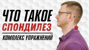 СПОНДИЛЕЗ. БОЛИТ ШЕЯ. Причины и профилактика. Топ 5 Упражнений при Спондилезе