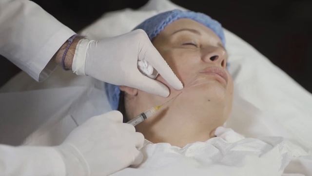 Mesoheal Dual-ით სახის ვექტორული არმირება (კანულის ტექნიკით) - პრაქტიკული ნაწილი