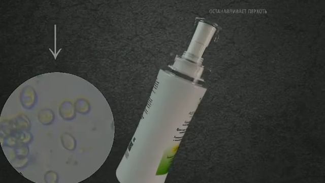 #седые_волосы#выподение___волос#перхоть# смотреть онлайн