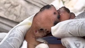 Jigger digging Eugene - join this channel and watch 1000s jigger videos