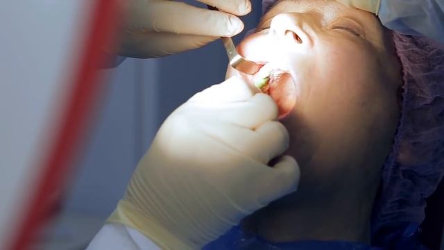 ROOTT имплантация. ? История и преимущества системы имплантации ROOTT.