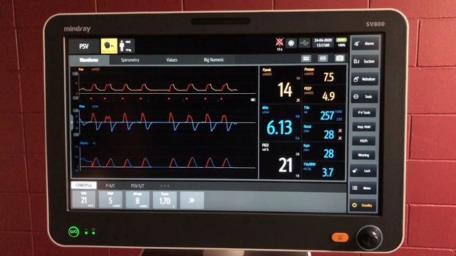 Mindray SV800 Non invasive modes