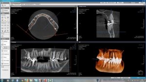 Демонстрация программного обеспечения OnDemand3D Dental