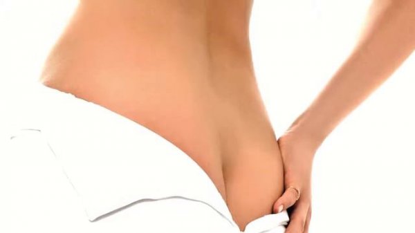 Геморрой, симптомы, лечение, препараты