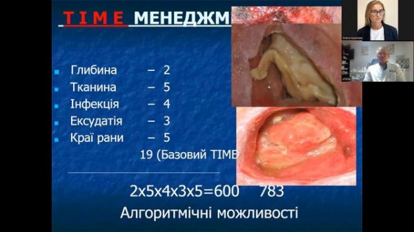 Догляд за ранами