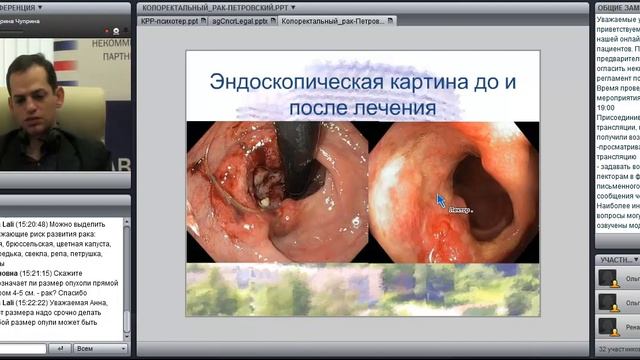 Онлайн-школа пациентов 16.11.2011г. по колоректальному раку часть 1 смотреть онлайн