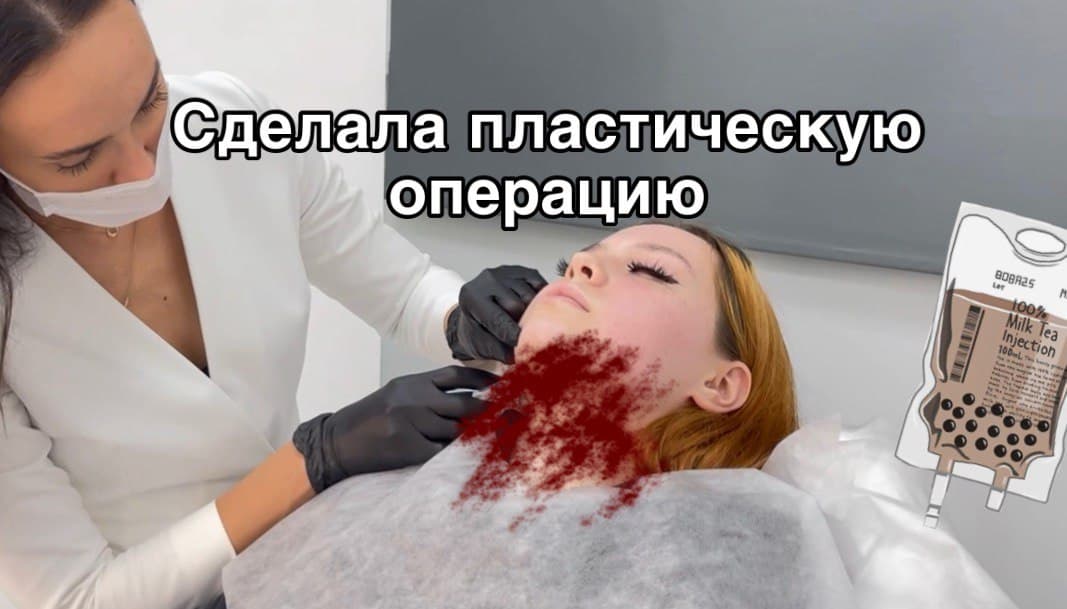 СДЕЛАЛА ПЛАСТИЧЕСКУЮ ОПЕРАЦИЮ