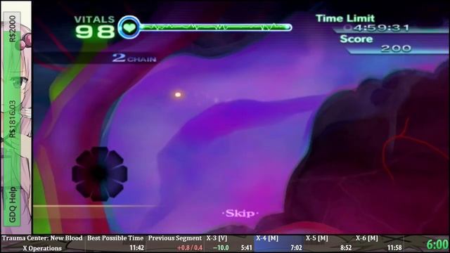 Trauma Center New Blood X Operations in 11:45 [Former World Record] смотреть онлайн