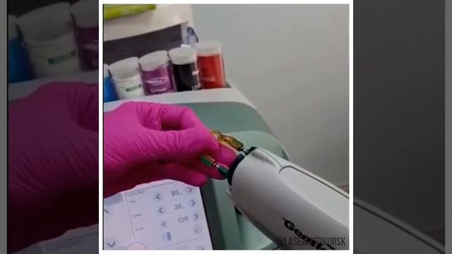 Лазерная эпиляция на аппарате «Candela Gentle Max» смотреть онлайн