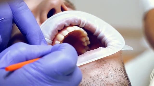 Керамические вкладки мнение эксперта смотреть онлайн